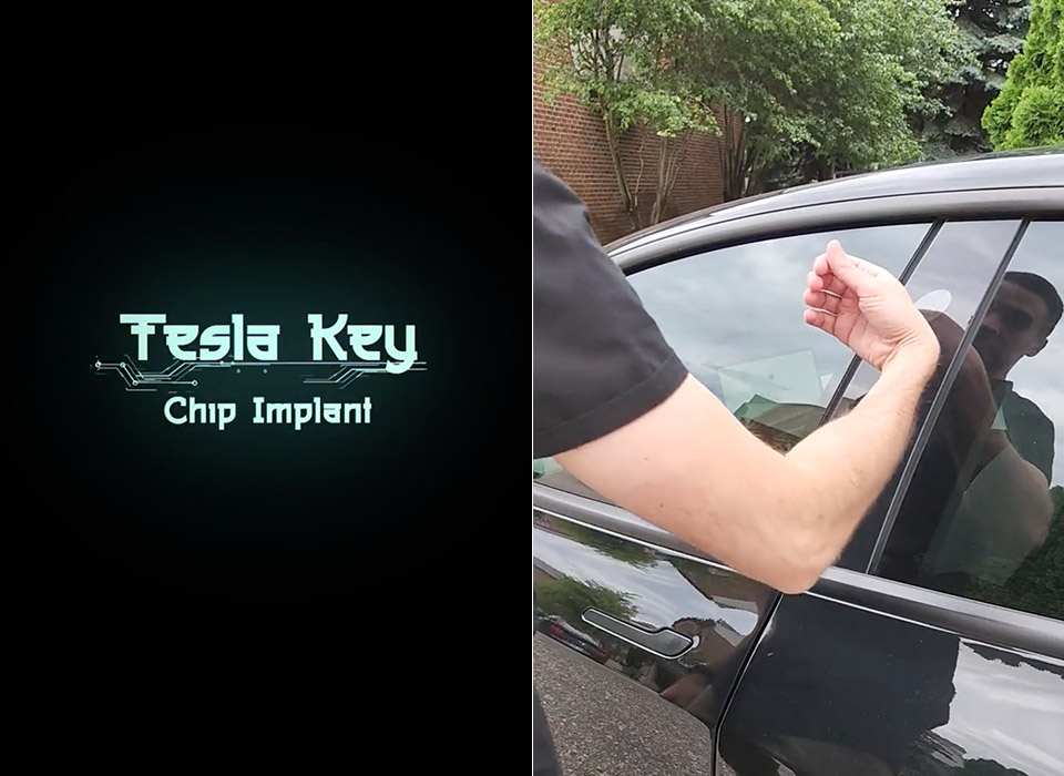 Implant Tesla Key Hand